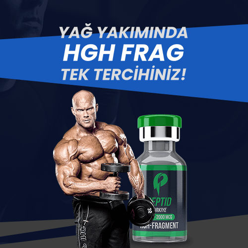 Kenar Çubuğu — Üst